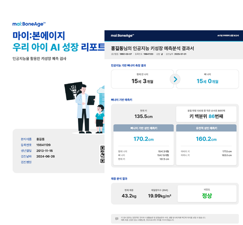 AI 성장분석 보고서